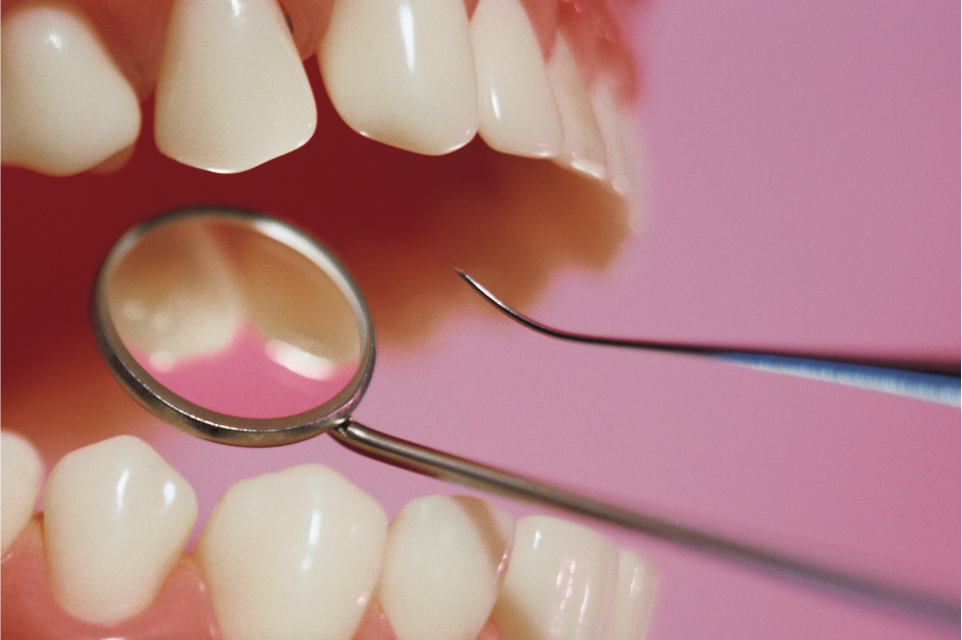 A close up of a tooth with two metal tools